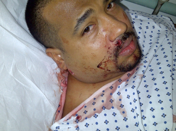 Claudio Antonio Abreu, herido de un balazo en el rostro.