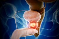 El Día Nacional de la Concientización y Lucha contra el Cáncer de Próstata se conmemora cada 19 de noviembre.