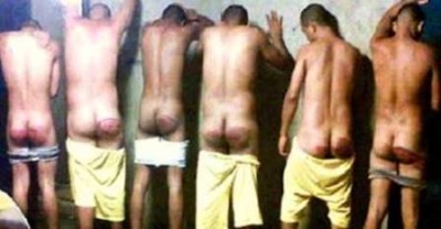 Así lucen los internos en la cárcel de Mao-Valverde, luego que son torturados por el personal penitenciario