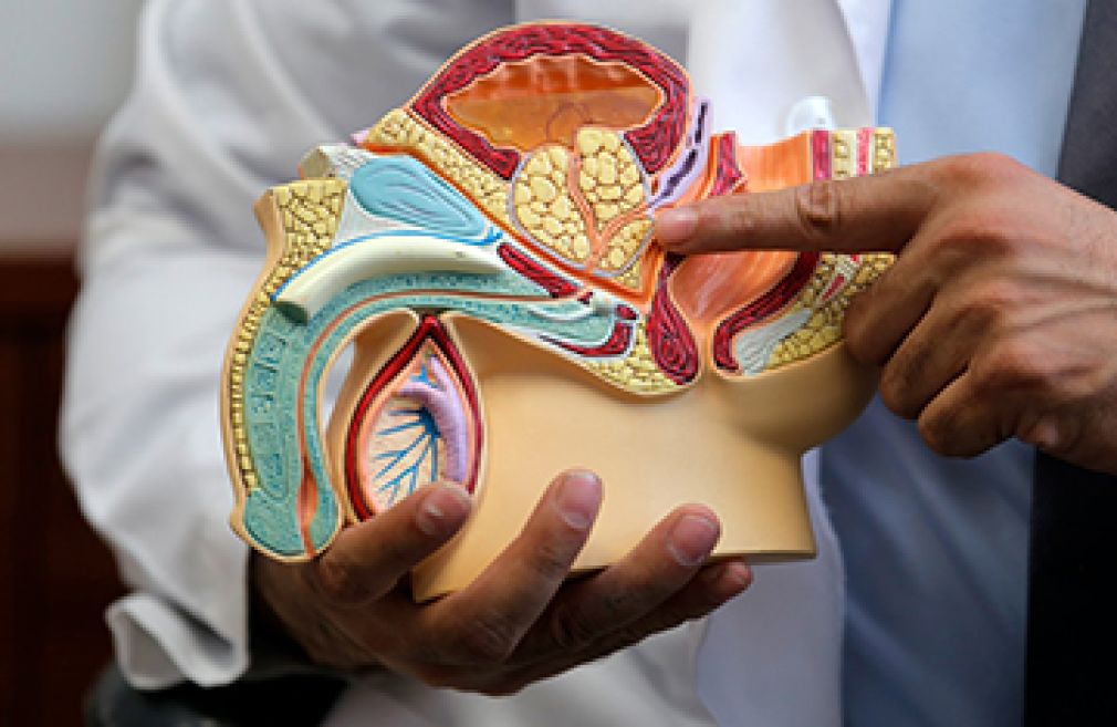 Un médico urólogo utiliza una maqueta del área de la pelvis en corte transversal para señalar el área donde se encuentra la próstata dentro del cuerpo humano. Foto: Milenio.com