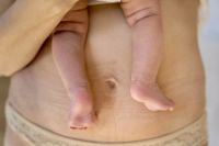  Cirugía plástica postparto: cuándo es recomendable y qué cambios corporales pueden abordarse tras la maternidad.