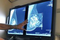 CMD provincia SD denuncia faltan mamografías en SDO.