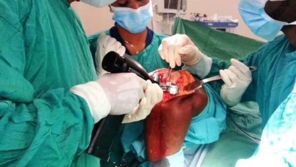 Realizan el primer trasplante de rodilla en el hospital de Monte Plata: 
