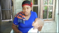 Madre pide ayuda para salvar a su hijo que padece de  &#039;&#039;Hidrocefalia&#039;&#039;: 