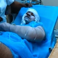 Mujer le prende fuego a marido en San Pedro de Macoris 