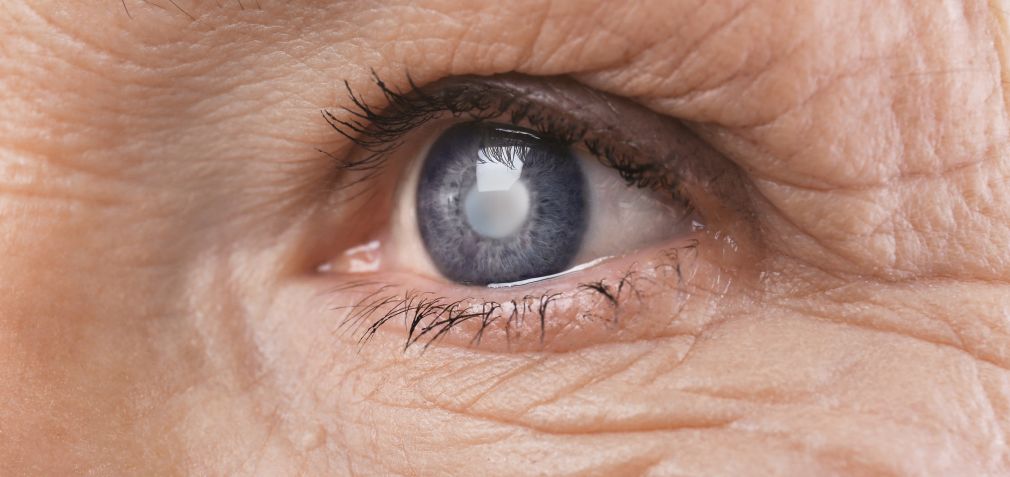 2% población sufre glaucoma y puede perder la visión.