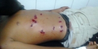 Niño de 12 años resulta herido cuando patrulla PN dispara a multitude: