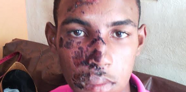 Joven agredido por la Policia Victor Manuel Bautista