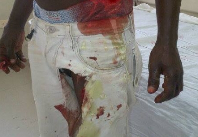 Dos haitianos heridos de machete tras sostener riña en Neiba